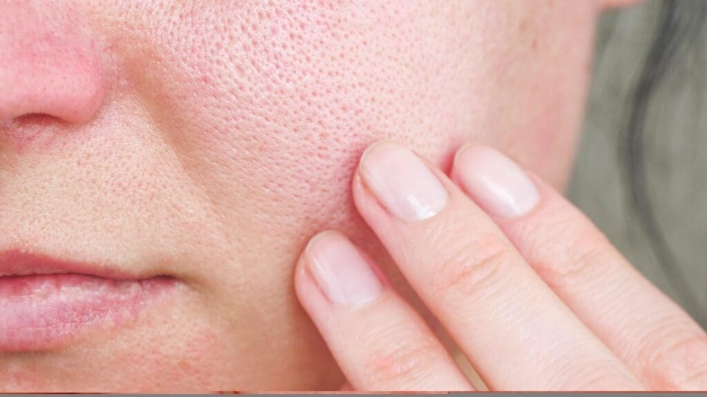 close up of woman with visible enlarged pores and textured skin