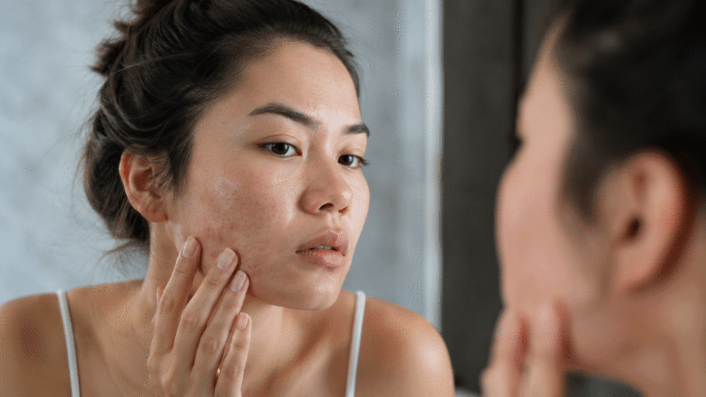 Rough skin on face