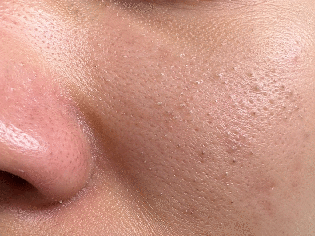 How to Shrink Pores: Causes, Treatments, and Tips 1 Shrink pores