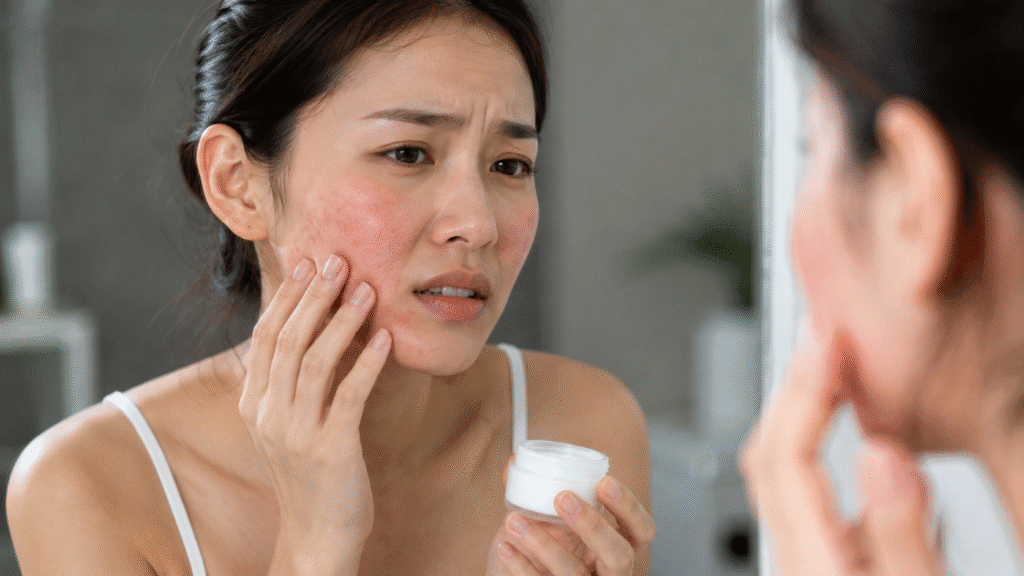 why does my face burn when I put moisturizer on